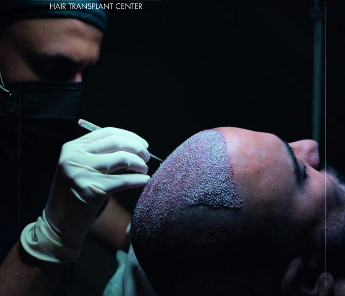 5-1-scaled 5-1-scaled